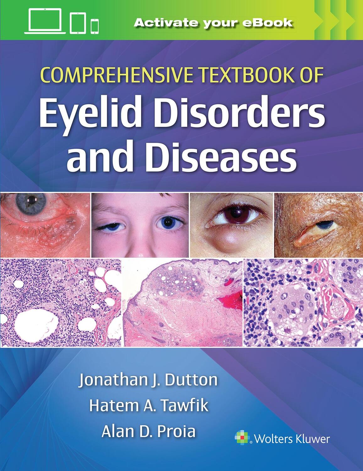 Cover: 9781975146146 | Comprehensive Textbook of Eyelid Disorders and Diseases | Buch | 2022