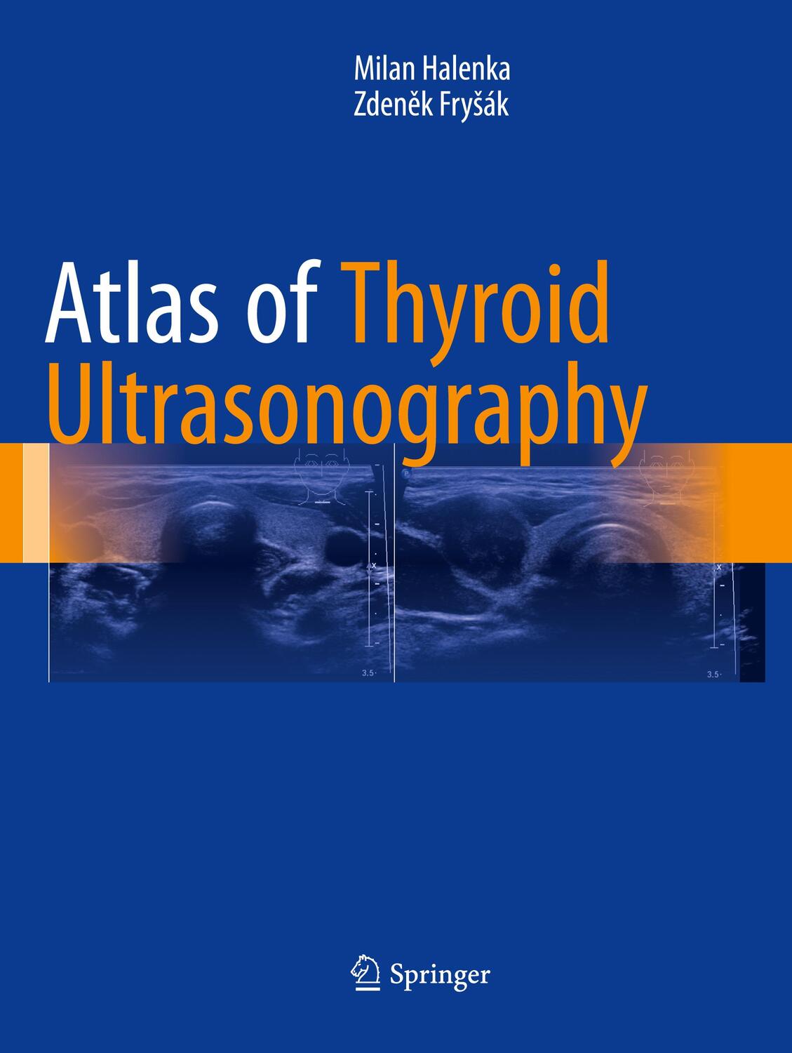 Cover: 9783319852379 | Atlas of Thyroid Ultrasonography | Zden¿k Fry¿ák (u. a.) | Taschenbuch