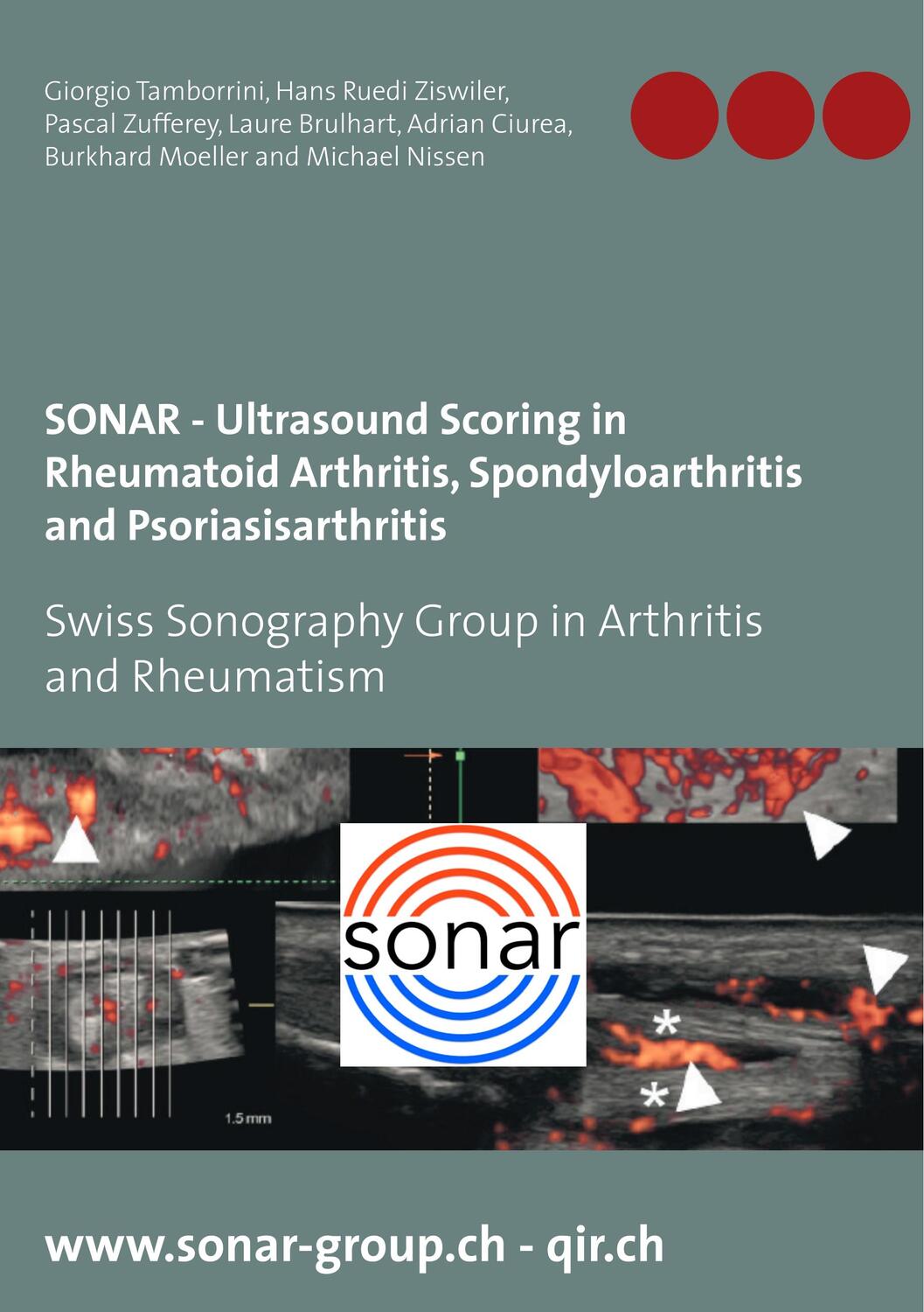Cover: 9783749478309 | SONAR - Ultrasound Scoring in Rheumatoid Arthritis,...