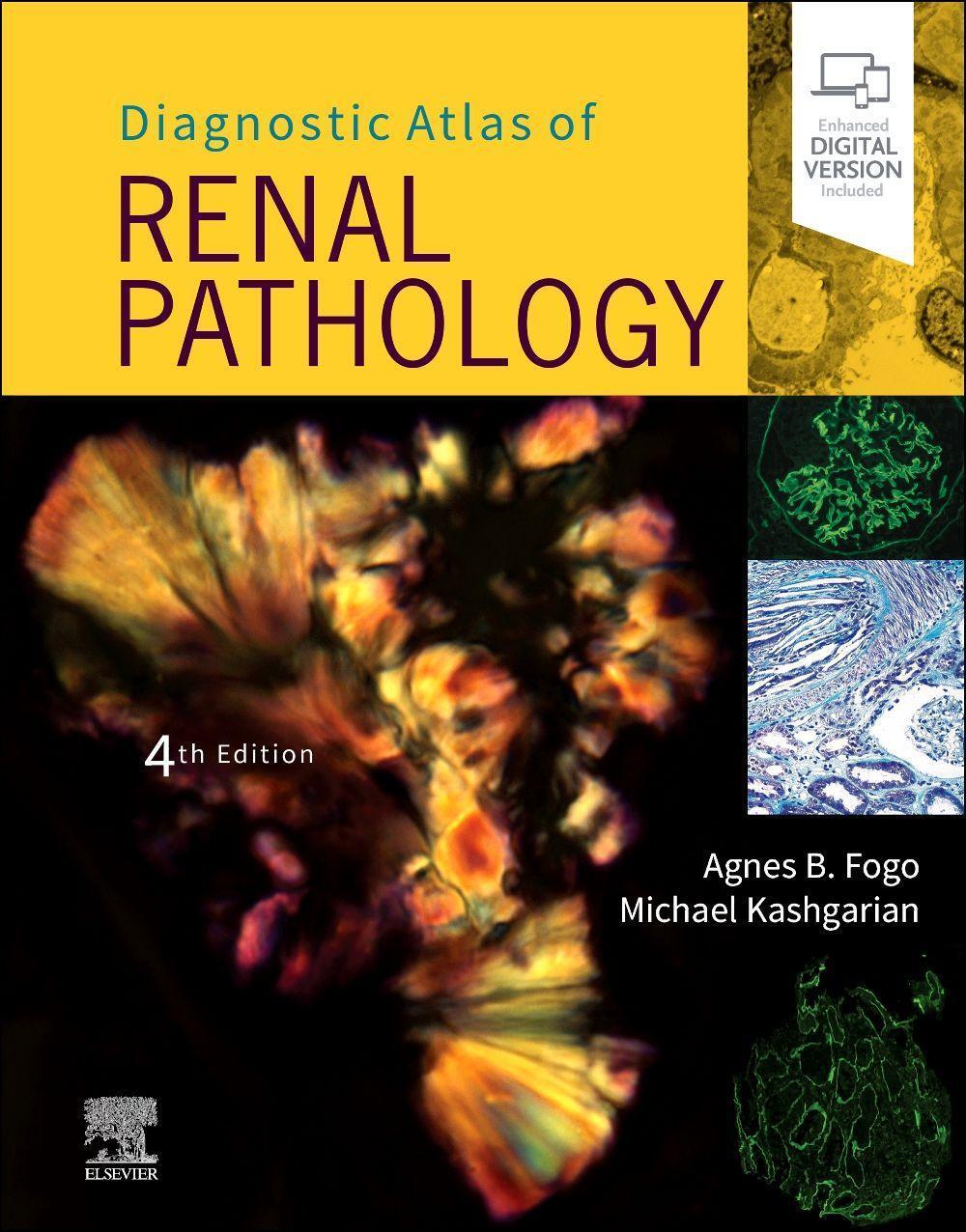 Cover: 9780323721639 | Diagnostic Atlas of Renal Pathology | Agnes B. Fogo (u. a.) | Buch
