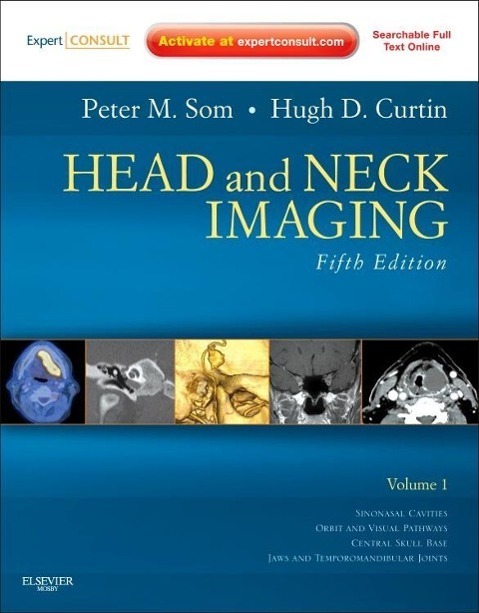Cover: 9780323053556 | Head and Neck Imaging - 2 Volume Set | Hugh D. Curtin (u. a.) | Buch