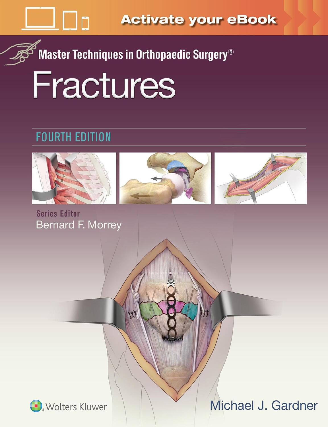 Cover: 9781975139407 | Master Techniques in Orthopaedic Surgery: Fractures | Gardner | Buch