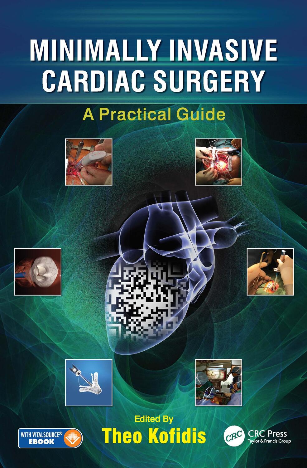Cover: 9781498736466 | Minimally Invasive Cardiac Surgery | A Practical Guide | Theo Kofidis