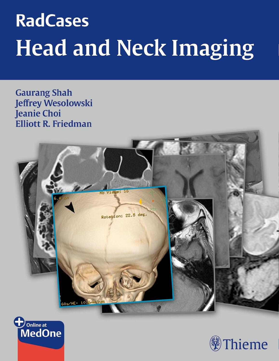 Cover: 9781604061932 | RadCases Head and Neck Imaging | Gaurang Vrindavan Shah (u. a.) | Buch