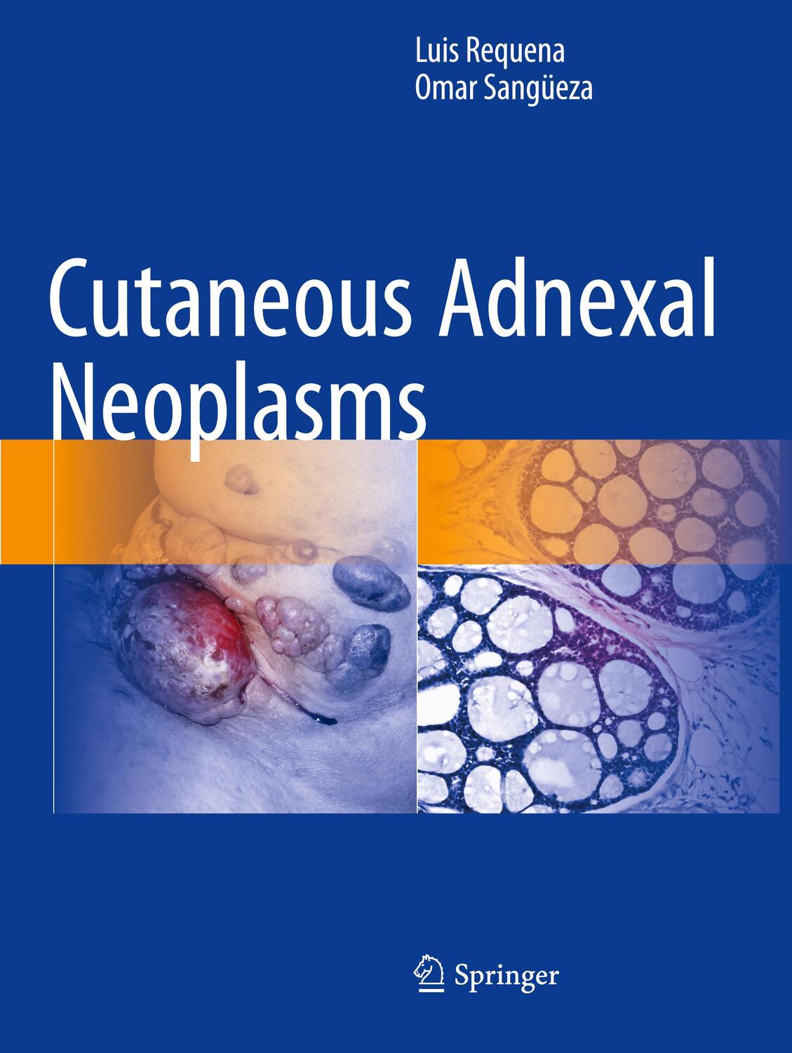 Cover: 9783319833538 | Cutaneous Adnexal Neoplasms | Omar Sangüeza (u. a.) | Taschenbuch