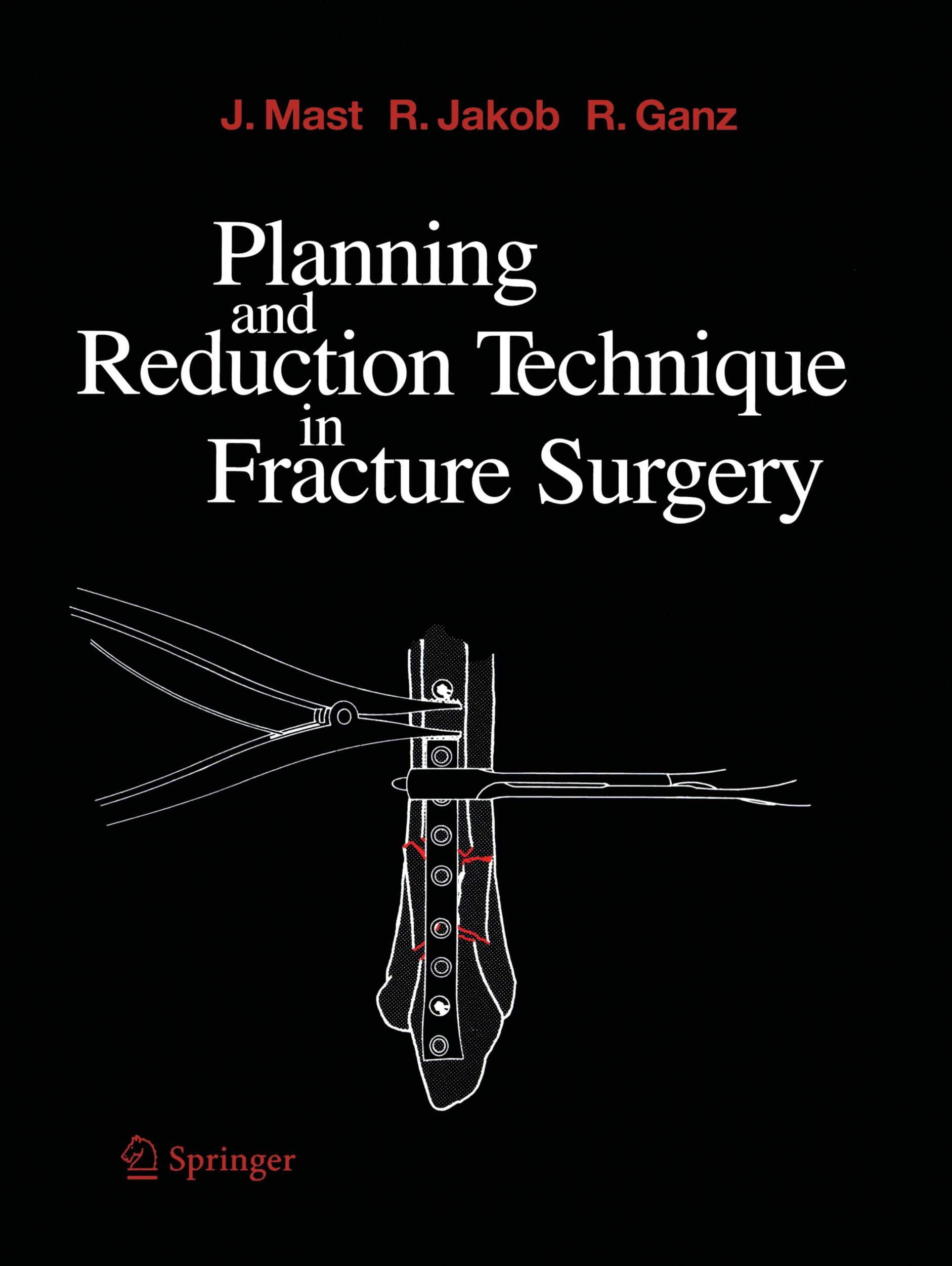 Cover: 9783642647840 | Planning and Reduction Technique in Fracture Surgery | Mast (u. a.)