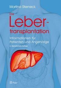 Cover: 9783958533547 | Die Lebertransplantation | Informationen für Patienten und Angehörige