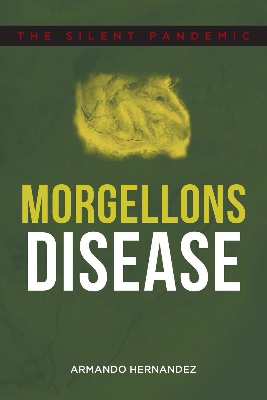 Cover: 9781648010248 | Morgellons Disease | The Silent Pandemic | Armando Hernandez | Buch
