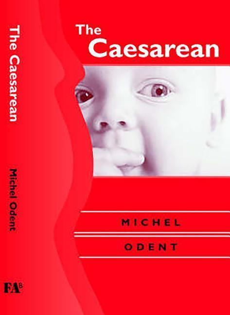 Cover: 9781853437182 | Odent, M: Caesarean | Michel Odent | Buch | Gebunden | Englisch | 2004