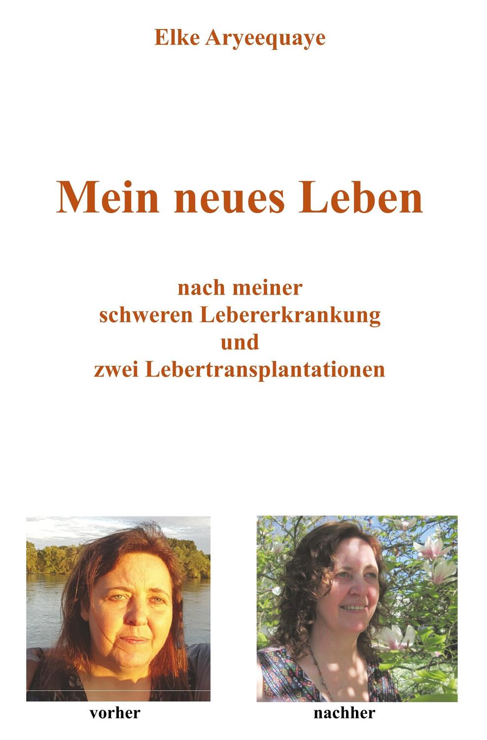 Cover: 9783961034345 | Mein neues Leben | Elke Aryeequaye | Taschenbuch | Re Di Roma-Verlag