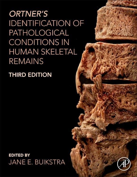 Cover: 9780128097380 | Ortner's Identification of Pathological Conditions in Human...