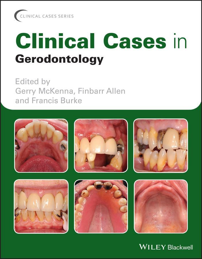 Cover: 9781119226598 | Clinical Cases in Gerodontology | Finbarr Allen (u. a.) | Taschenbuch