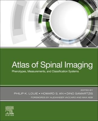 Cover: 9780323761116 | Atlas of Spinal Imaging | Philip K Louie (u. a.) | Taschenbuch | 2021
