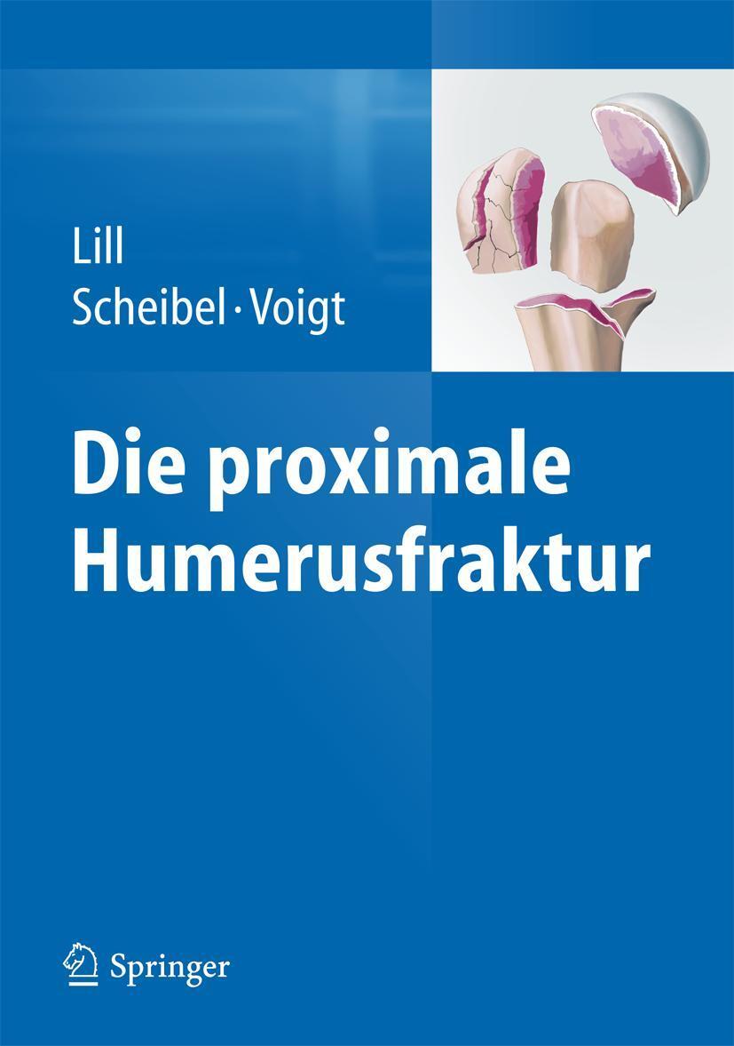 Cover: 9783642352560 | Die proximale Humerusfraktur | Helmut Lill (u. a.) | Buch | xi | 2014