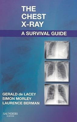 Cover: 9780702030468 | The Chest X-Ray: A Survival Guide | Gerald De Lacey (u. a.) | Buch