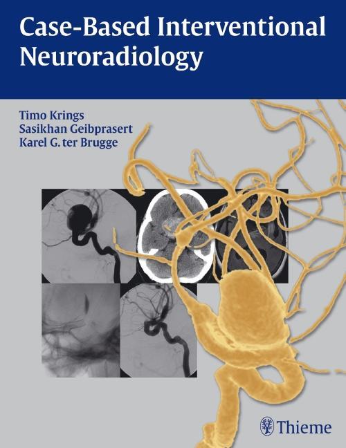 Cover: 9781604063738 | Case-Based Interventional Neuroradiology [With Access Code] | Buch