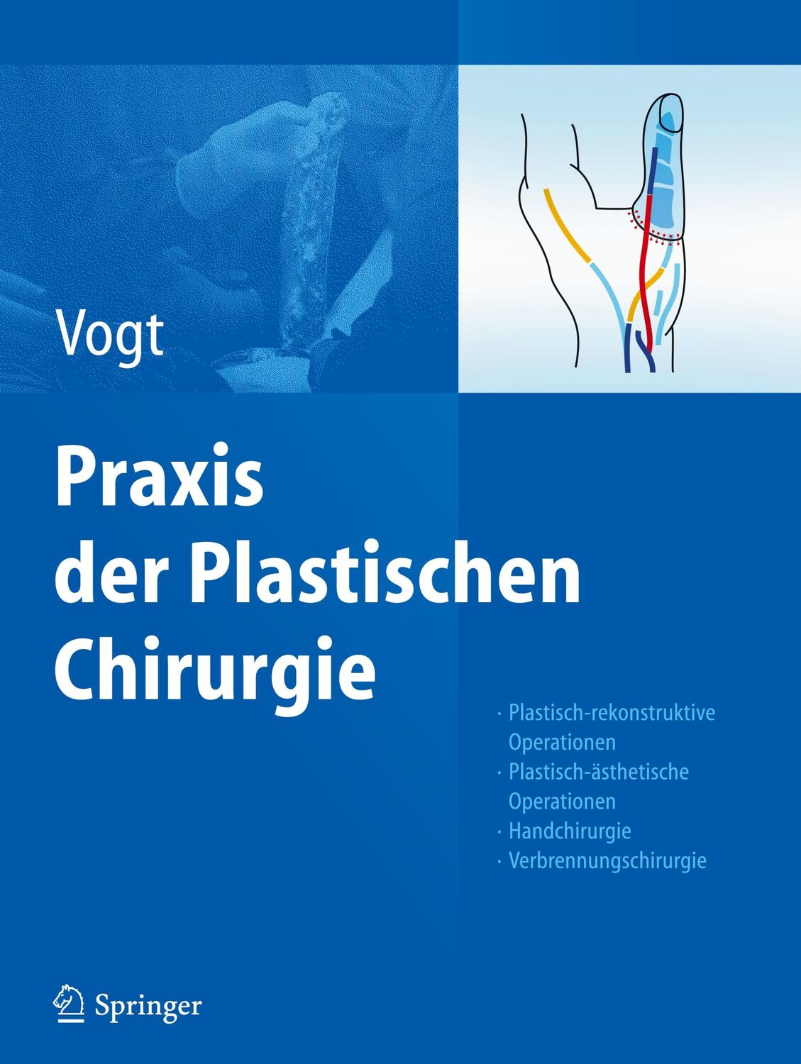 Cover: 9783540375715 | Praxis der Plastischen Chirurgie | Peter M. Vogt | Buch | XXXIV | 2011