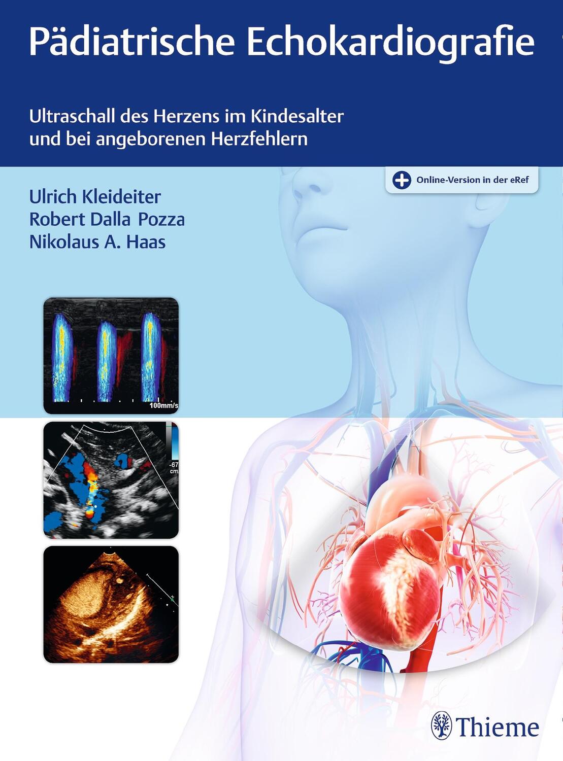 Cover: 9783132416048 | Pädiatrische Echokardiografie | Ulrich Kleideiter (u. a.) | Bundle