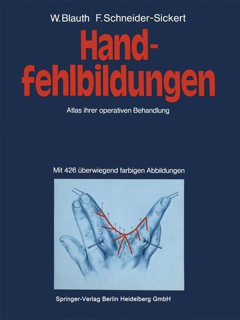 Cover: 9783662119891 | Handfehlbildungen | Atlas ihrer operativen Behandlung | Taschenbuch