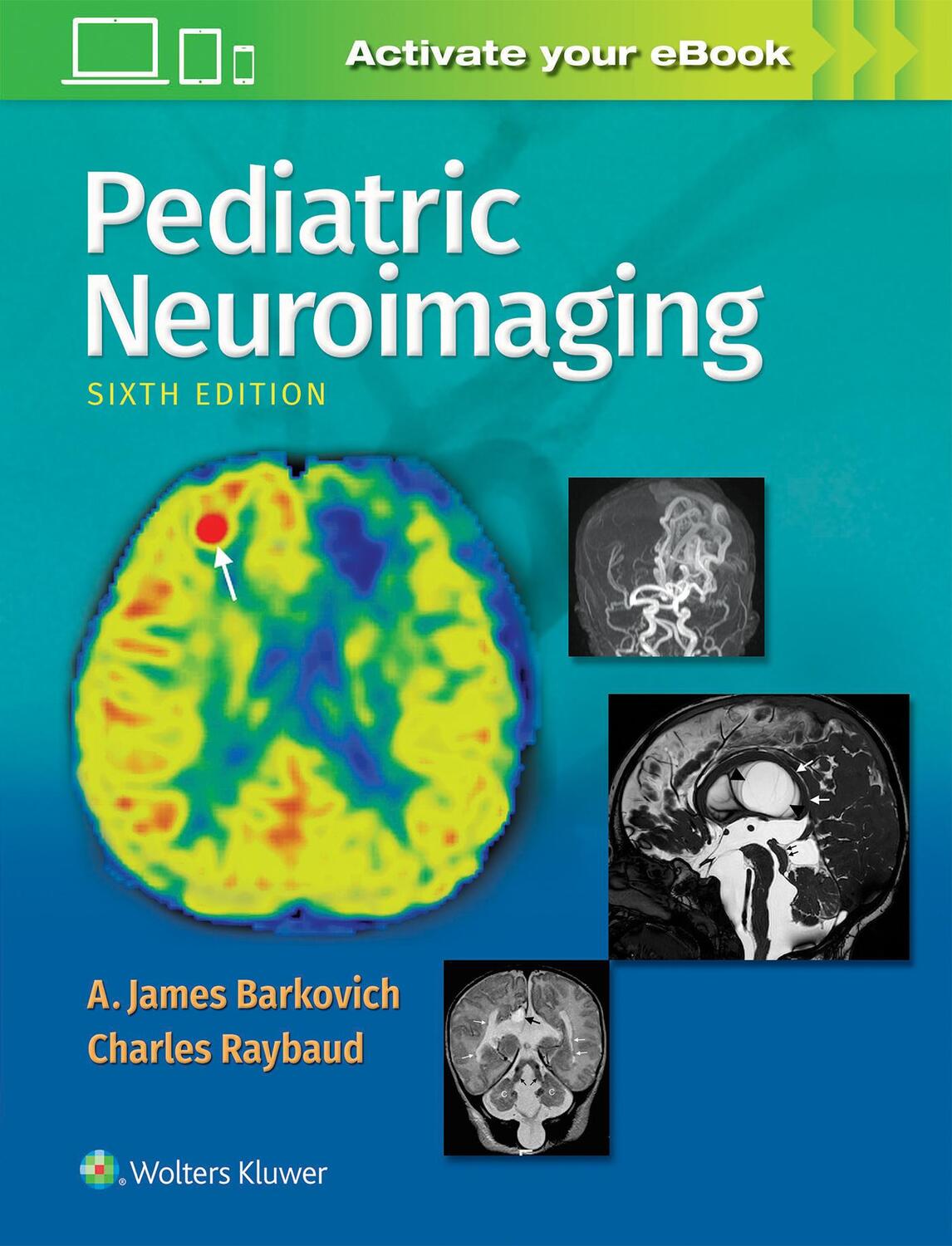 Cover: 9781496337207 | Pediatric Neuroimaging | A. James Barkovich | Buch | Gebunden | 2018