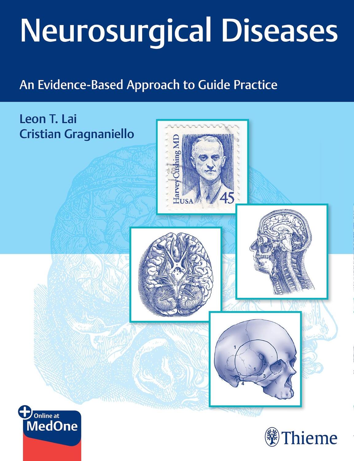 Cover: 9781684200511 | Neurosurgical Diseases | An Evidence-Based Approach to Guide Practice