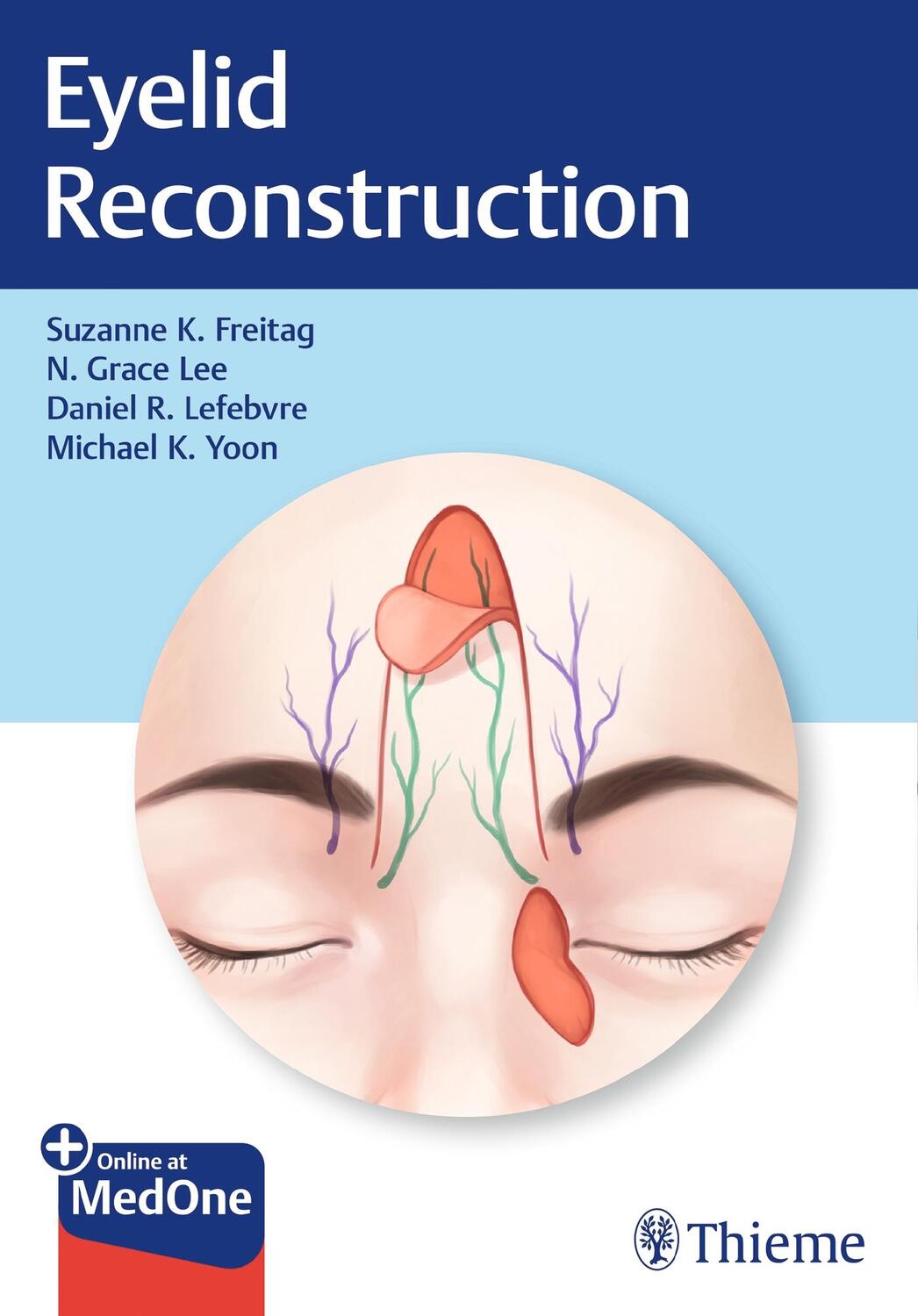Cover: 9781626238237 | Eyelid Reconstruction | Suzanne K. Freitag (u. a.) | Buch | Englisch