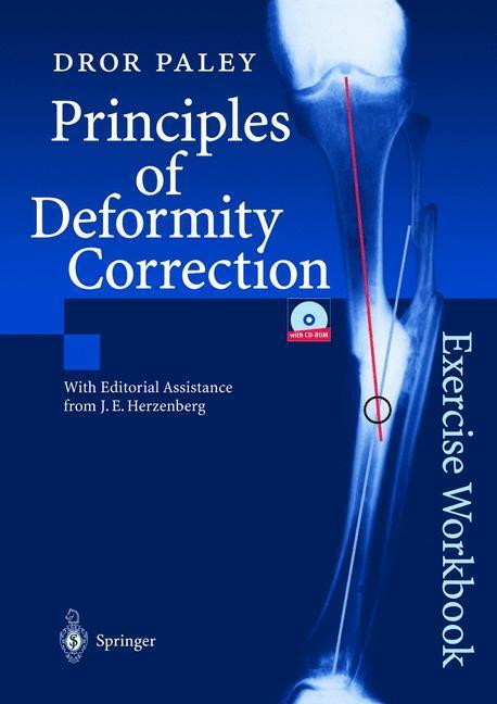 Cover: 9783540441618 | Principles of Deformity Correction | Exercise Workbook | Dror Paley
