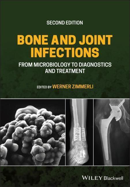 Cover: 9781119720652 | Bone and Joint Infections | Werner Zimmerli | Buch | 464 S. | Englisch