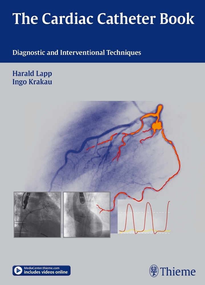 Cover: 9783131672711 | The Cardiac Catheter Book | Diagnostic and Interventional Techniques