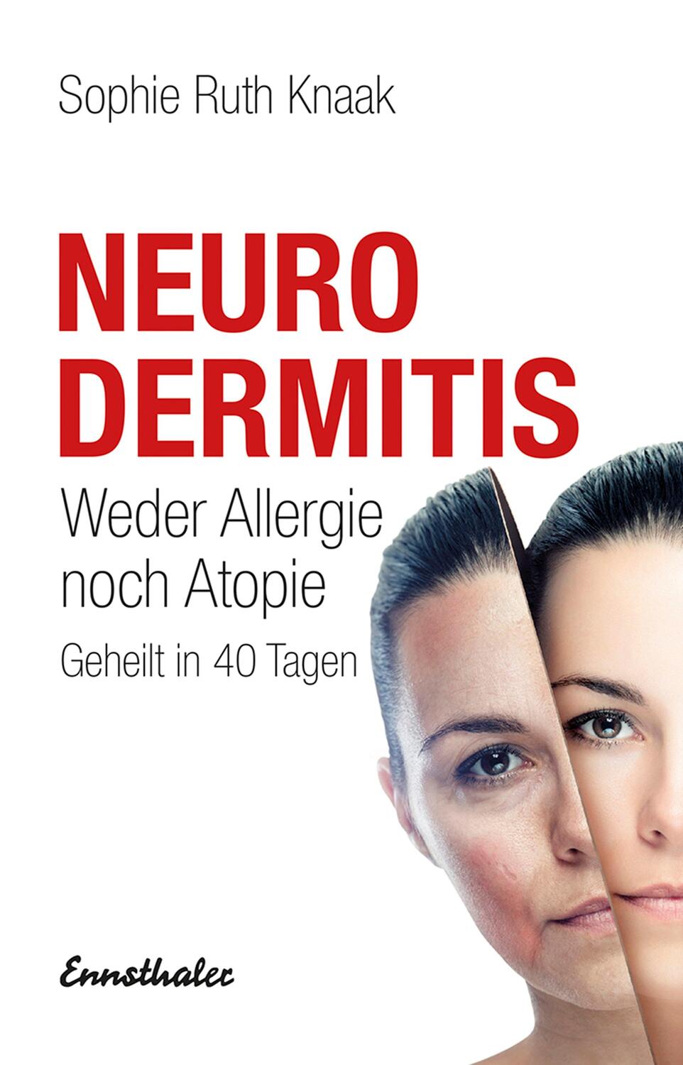 Cover: 9783850685184 | Neurodermitis | Weder Allergie noch Atopie. Geheilt in 40 Tagen | Buch
