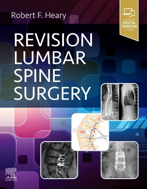 Cover: 9780323712019 | Revision Lumbar Spine Surgery | Buch | Gebunden | Englisch | 2021