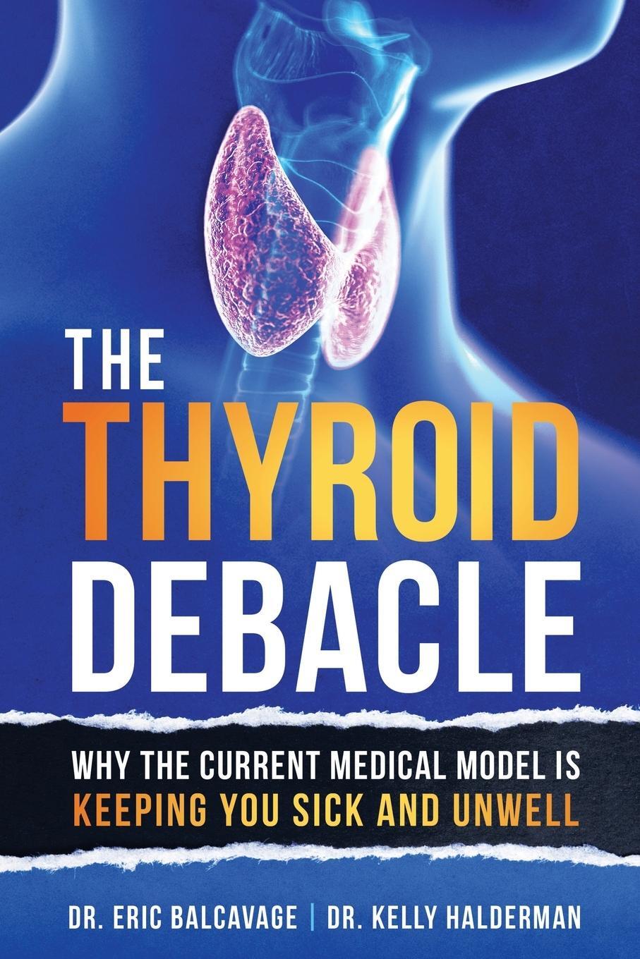 Cover: 9798765227992 | The Thyroid Debacle | Eric Balcavage (u. a.) | Taschenbuch | Paperback