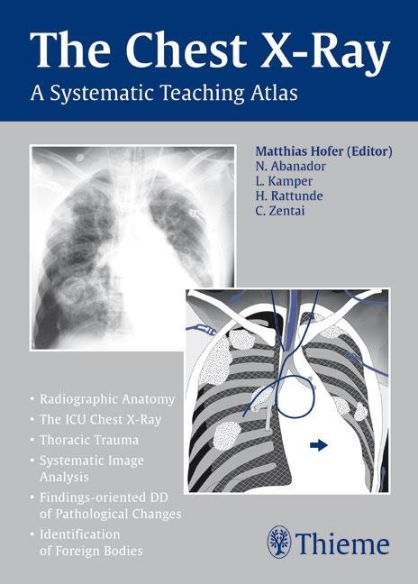 Cover: 9783131442116 | Chest X-ray Trainer | A Systematic Teaching Atlas | Matthias Hofer