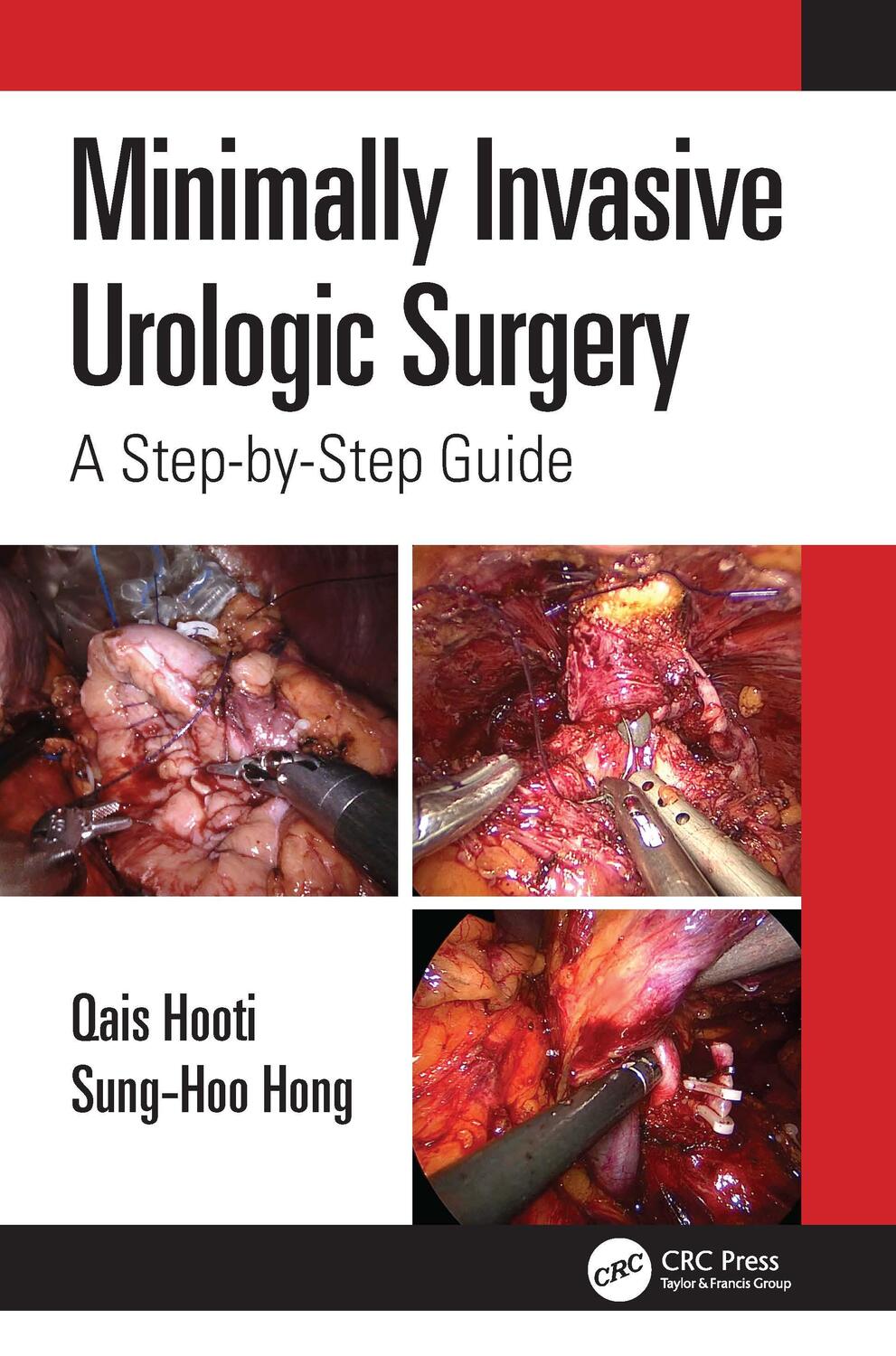 Cover: 9781032257105 | Minimally Invasive Urologic Surgery | A Step-by-Step Guide | Buch