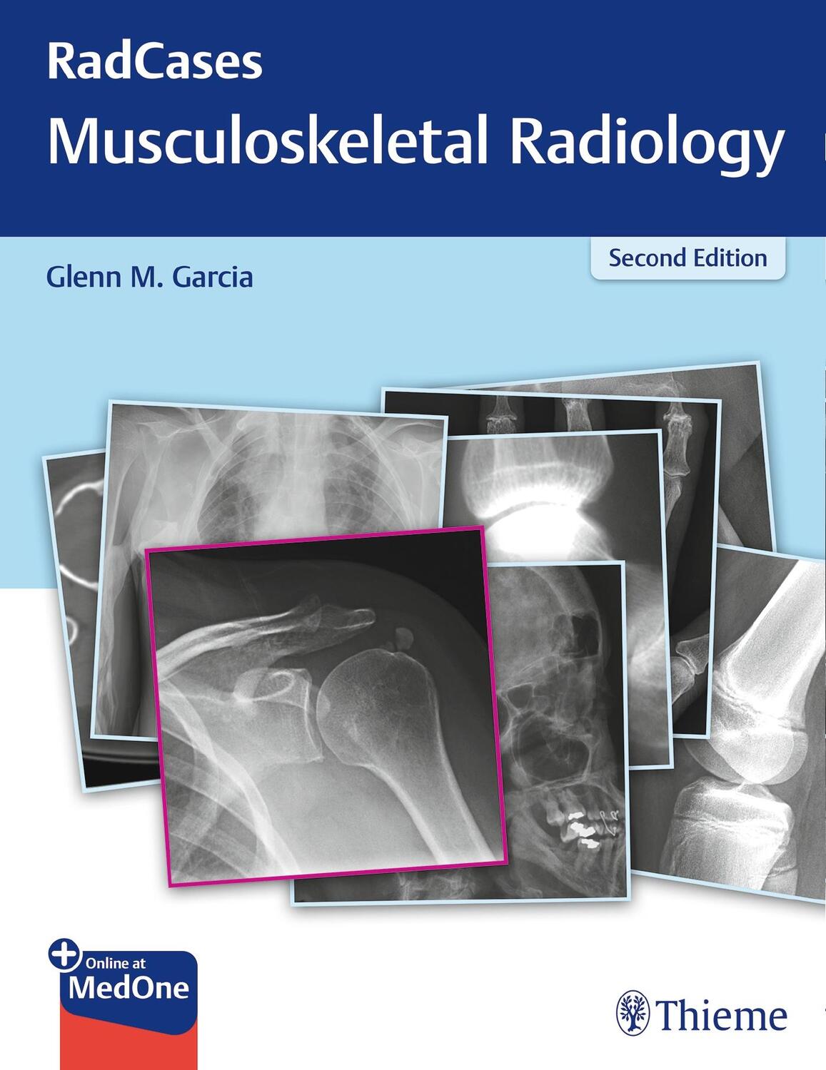 Cover: 9781626232440 | Radcases Musculoskeletal Radiology | Glenn M. Garcia | Taschenbuch