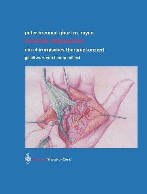Cover: 9783709173923 | Morbus Dupuytren | Ein chirurgisches Therapiekonzept | Brenner (u. a.)