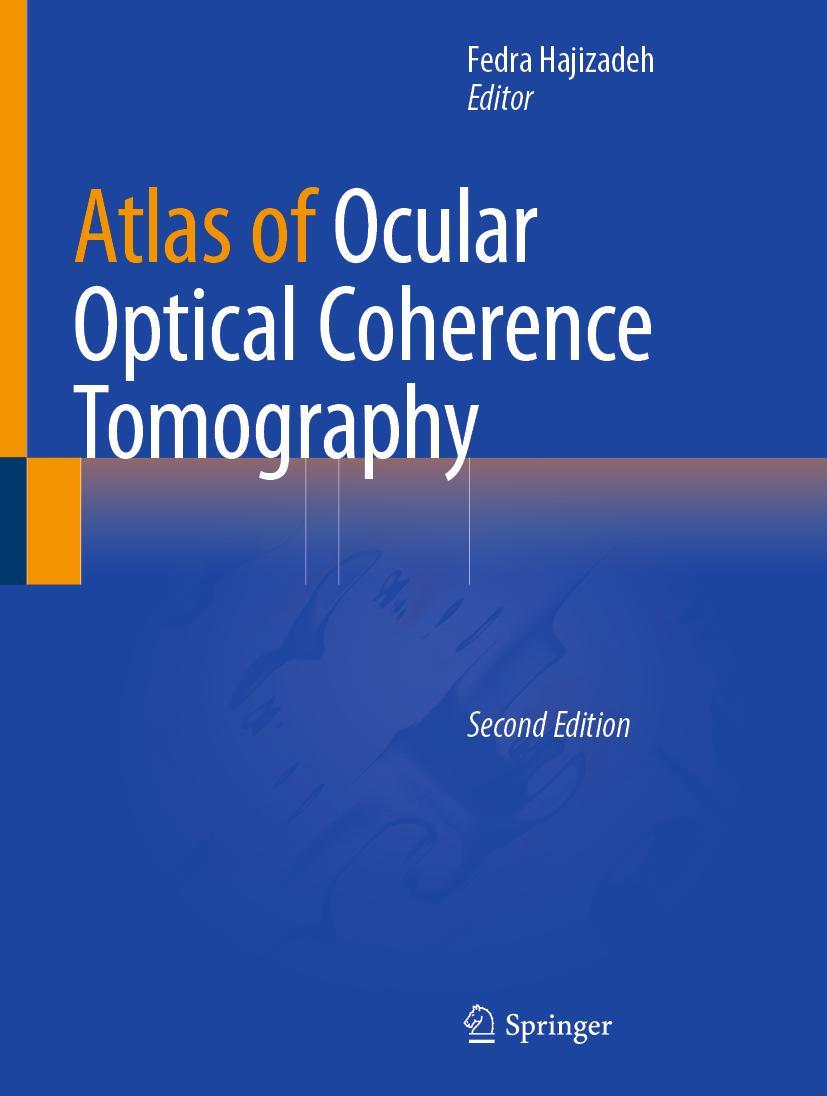 Cover: 9783031074097 | Atlas of Ocular Optical Coherence Tomography | Fedra Hajizadeh | Buch