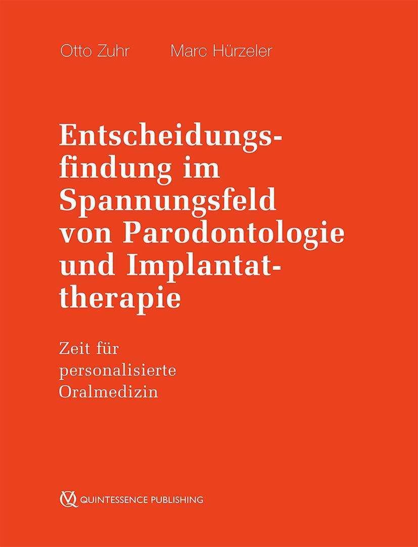 Cover: 9783868676259 | Entscheidungsfindung im Spannungsfeld von Parodontologie und...