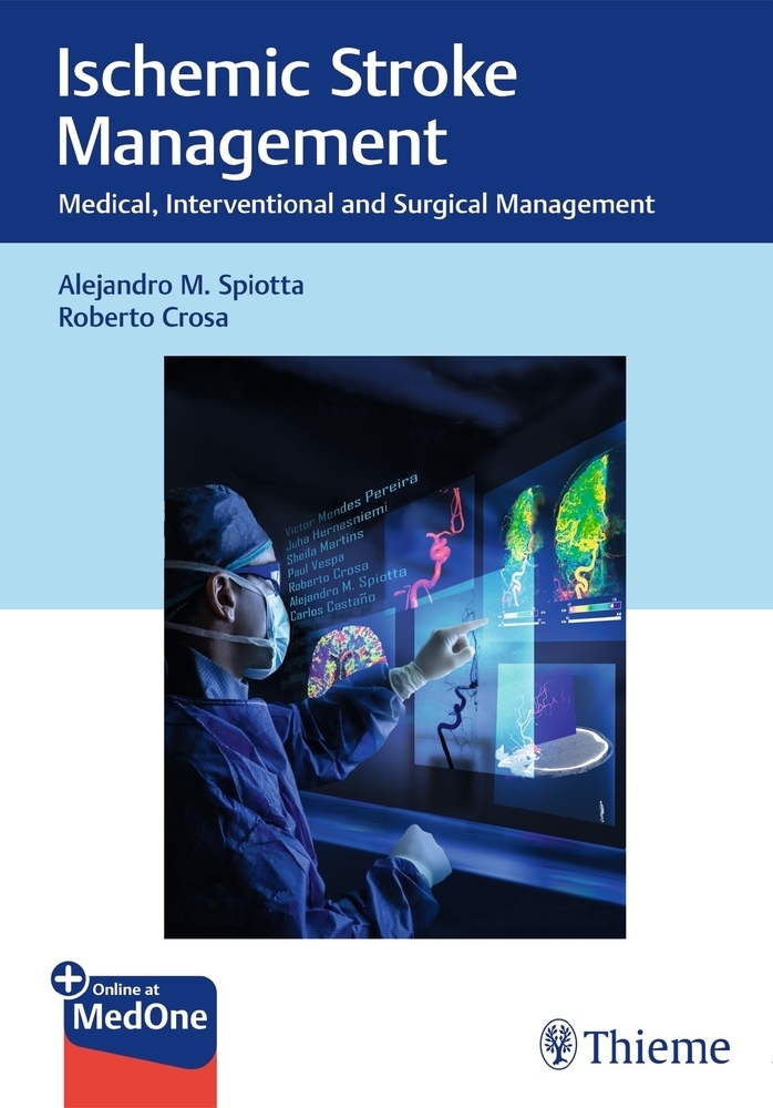 Cover: 9781626239081 | Ischemic Stroke Management | Plus Online at MedOne | Spiotta (u. a.)