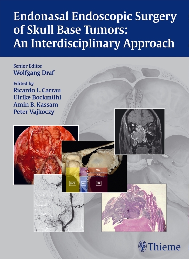 Cover: 9783131546715 | Endonasal Endoscopic Surgery of Skull Base Tumors | Buch | 362 S.