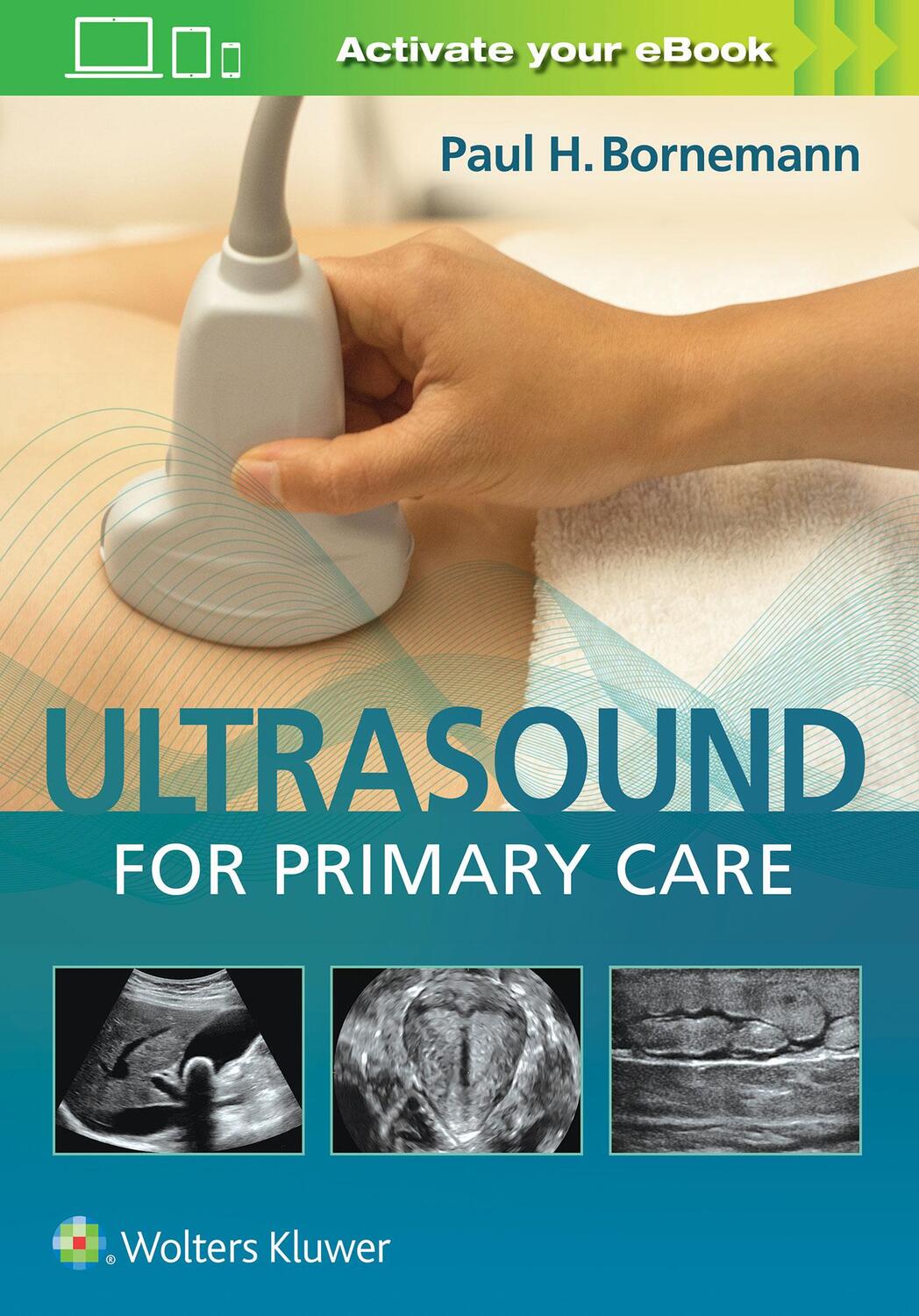 Cover: 9781496366986 | Ultrasound for Primary Care | Paul Bornemann | Buch | Englisch | 2019