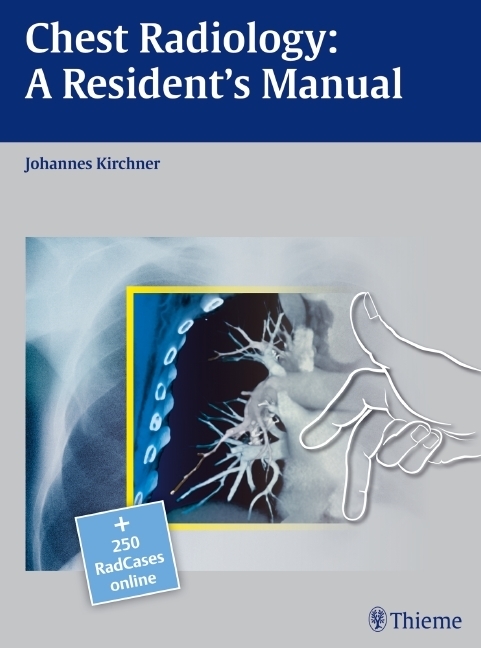 Cover: 9783131538710 | Chest Radiology | A Resident's Manual | Johannes Kirchner | Buch