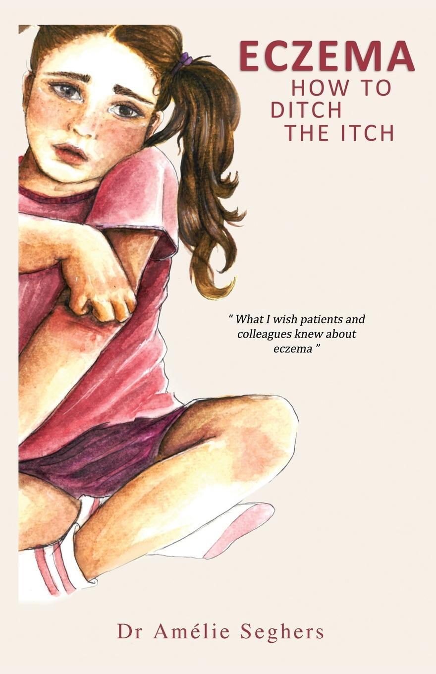 Cover: 9781839751271 | Eczema | How to Ditch the Itch | Amélie Seghers | Taschenbuch | 2020