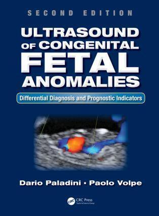 Cover: 9781466598966 | Ultrasound of Congenital Fetal Anomalies | Dario Paladini (u. a.)