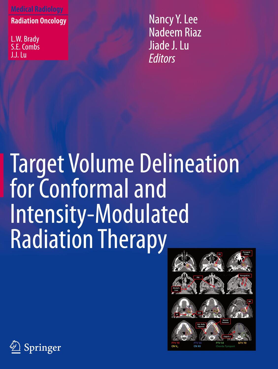 Cover: 9783319057255 | Target Volume Delineation for Conformal and Intensity-Modulated...