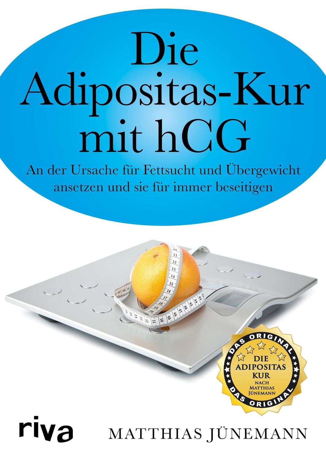 Cover: 9783868835977 | Die Adipositas-Kur mit HCG | Matthias Jünemann | Taschenbuch | Deutsch