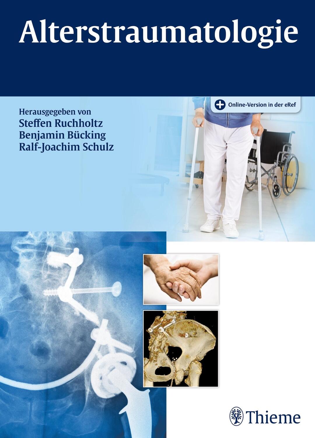 Cover: 9783131771919 | Alterstraumatologie | Steffen Ruchholtz (u. a.) | Bundle | 1 Buch