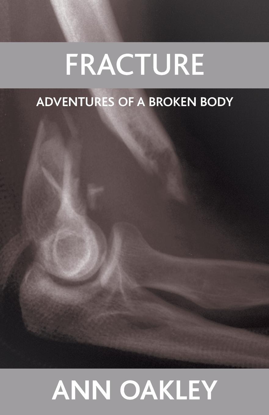 Cover: 9781861349378 | Fracture | Ann Oakley | Taschenbuch | Paperback | Englisch | 2007