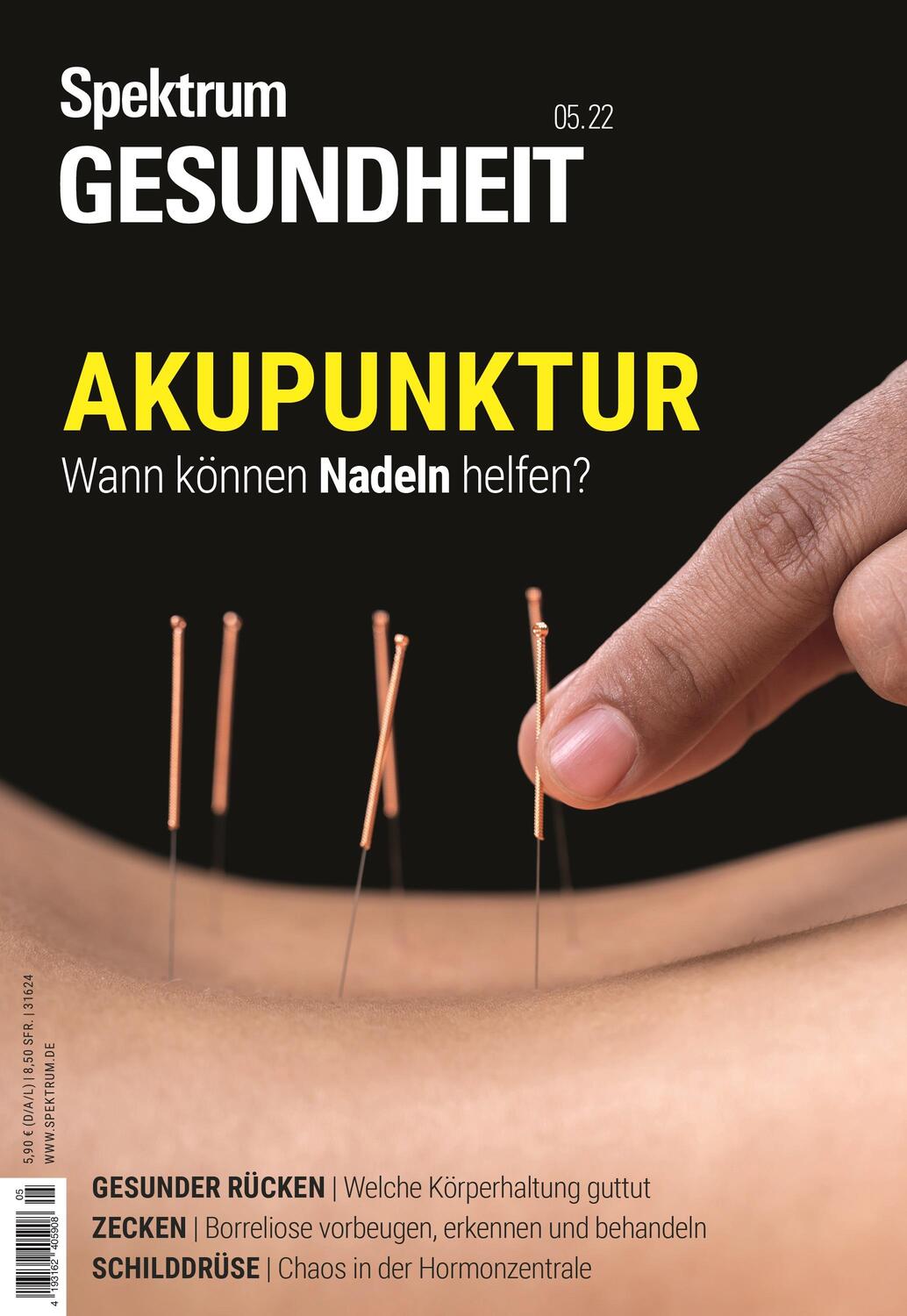 Cover: 9783958926196 | Spektrum Gesundheit- Akupunktur | Wann können Nadeln helfen? | Buch