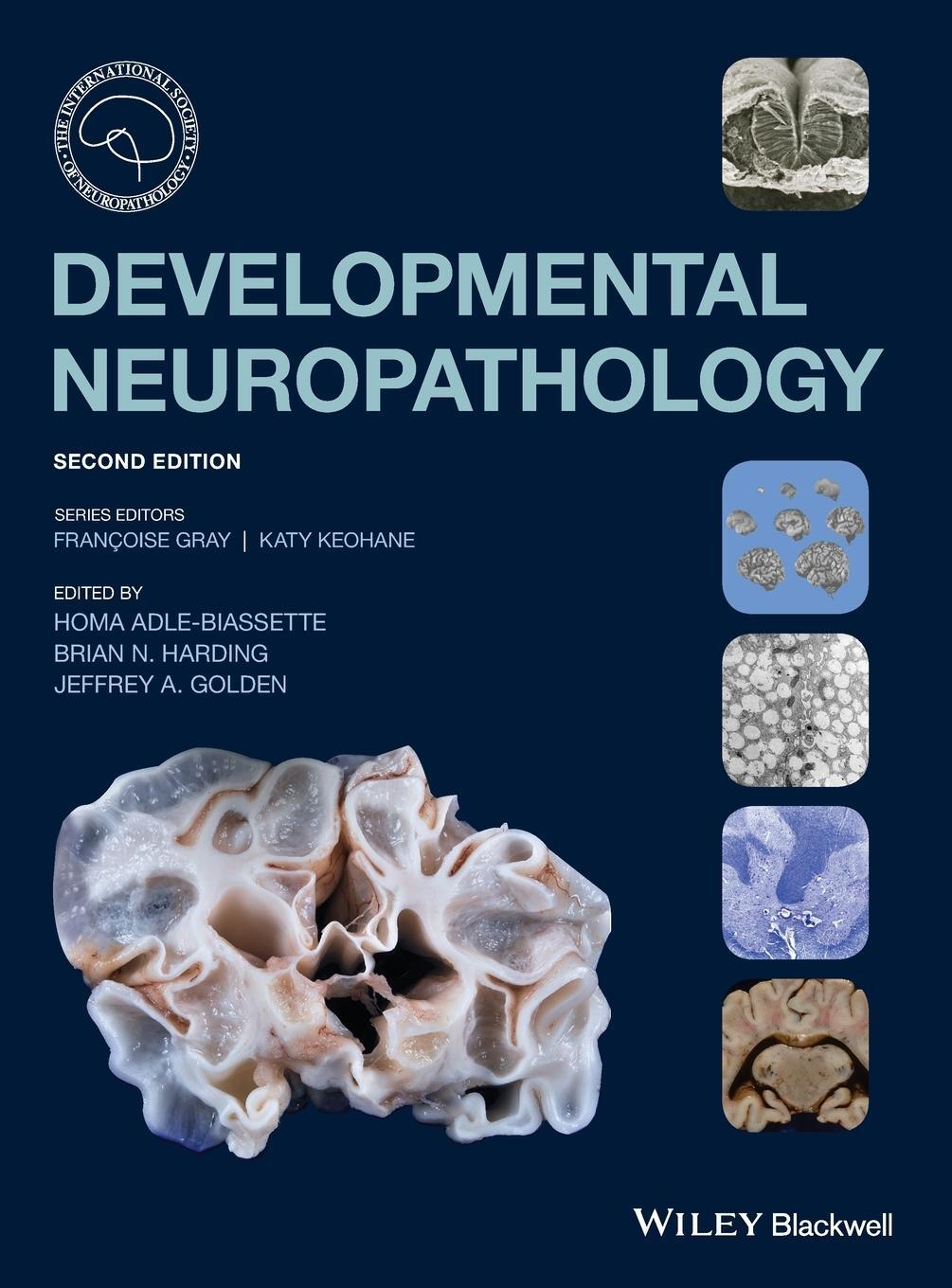 Cover: 9781119013082 | Developmental Neuropathology | Homa Adle-Biassette | Buch | Englisch